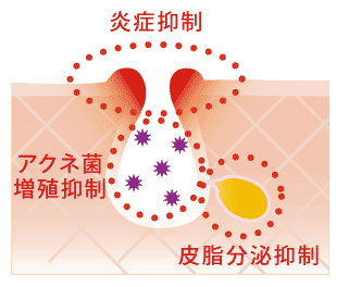 炎症抑制・アクネ菌繁殖抑制・皮脂分泌抑制