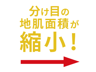 分け目の地肌面積が縮小