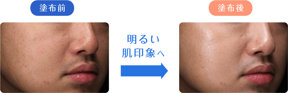 塗布前→塗布後 明るい肌印象へ