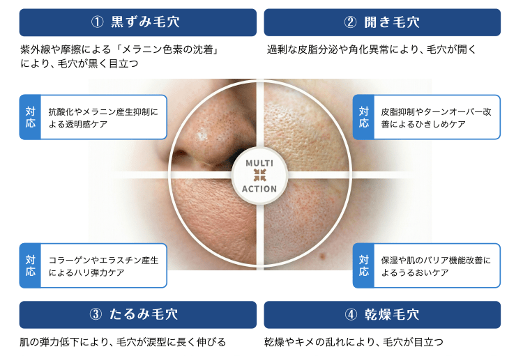MULTI ACTION:①黒ずみ毛穴/②開き毛穴/③たるみ毛穴/④乾燥毛穴|①黒ずみ毛穴:紫外線や摩擦による「メラニン色素の沈着」により、毛穴が黒く目立つ→対応:抗酸化やメラニン産生抑制による透明感ケア|②開き毛穴:過剰な皮脂分泌や角化異常より、毛穴が開く→対応:皮脂抑制やターンオーバー改善によるひきしめケア|③たるみ毛穴:肌の弾力低下により、毛穴が型に長く伸びる→対応:コラーゲンやエラスチン産生によるハリ弾力ケア|④乾燥毛穴:乾燥やキメが乱れにより、毛穴が目立つ→保湿や肌のバリア機能改善によるうるおいケア