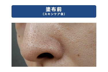 塗布前（スキンケア後）